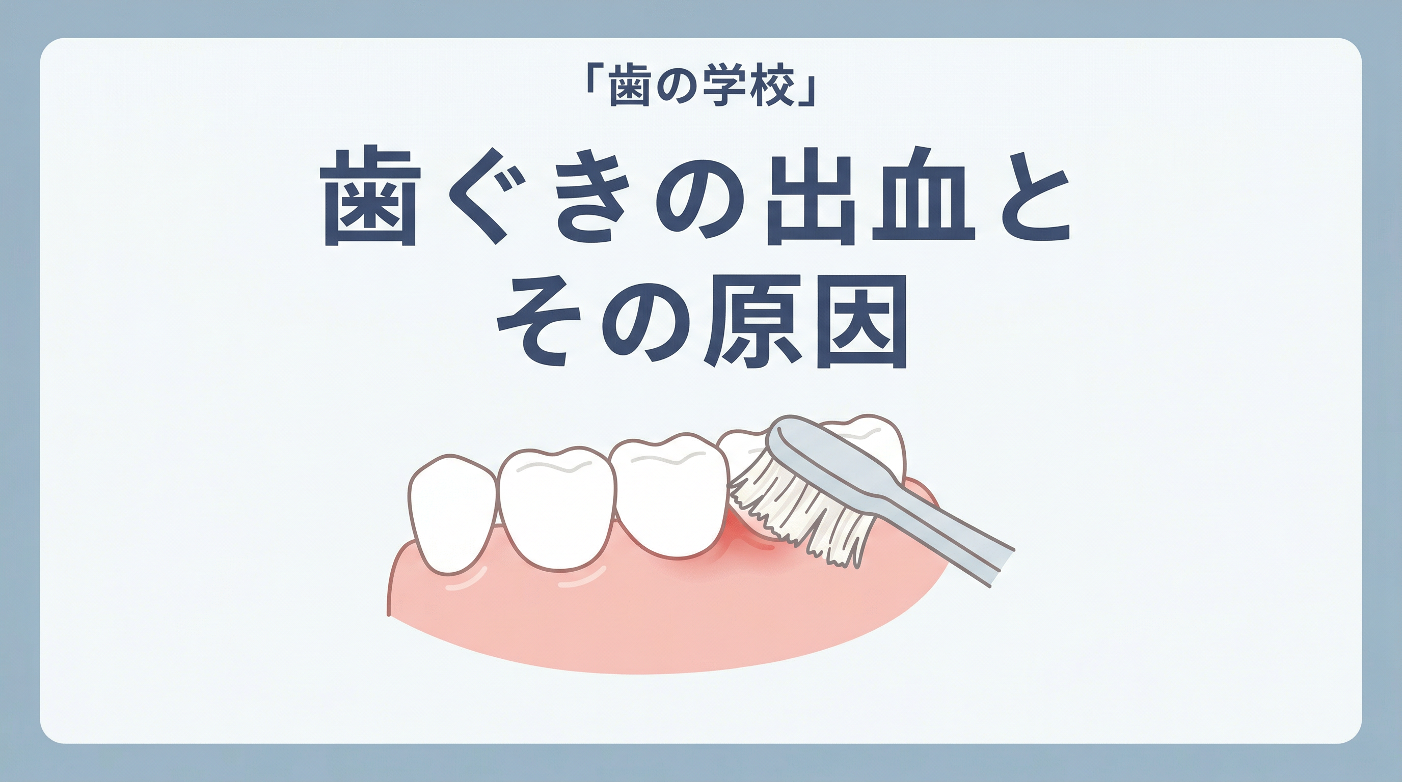 コラム：サムネイル画像